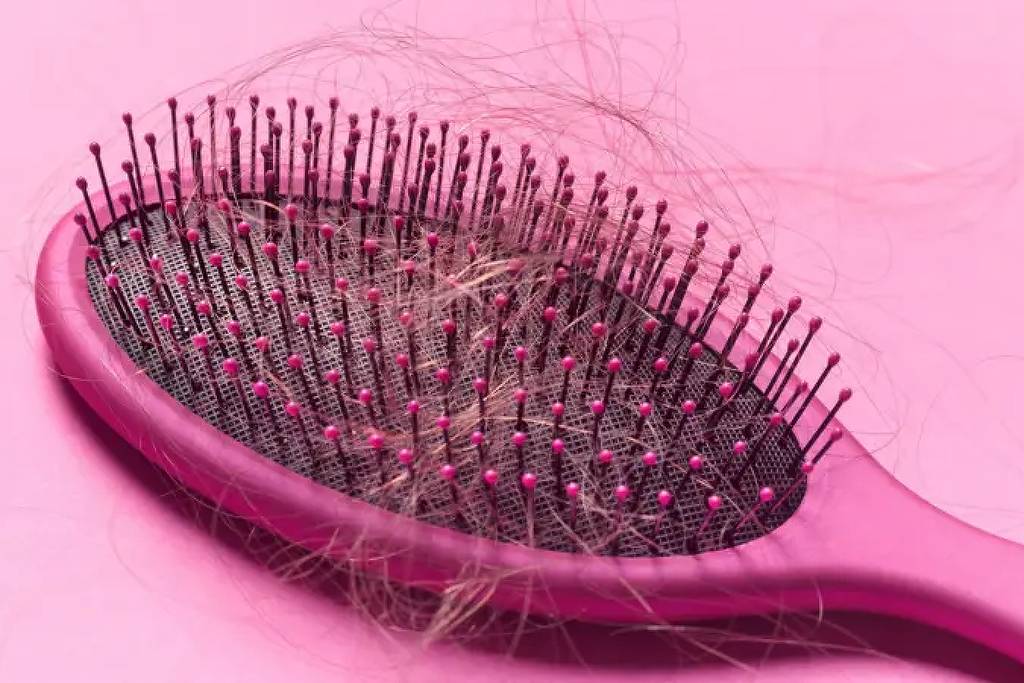 Escova com fios de cabelo indicando queda capilar; equipe de pesquisadores afirma ter conseguido recriar, em camundongos, o ciclo completo de crescimento do cabelo - Getty Images