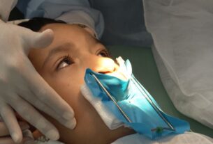 Tratamento de fissura labiopalatal no Centrinho