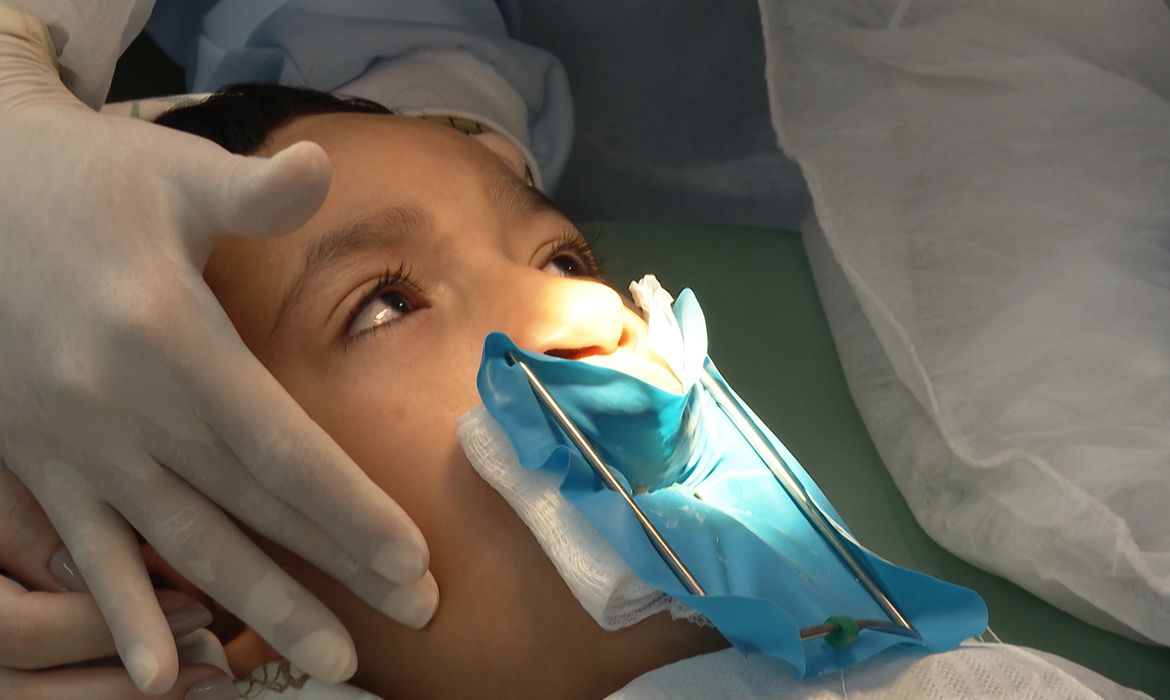 Tratamento de fissura labiopalatal no Centrinho