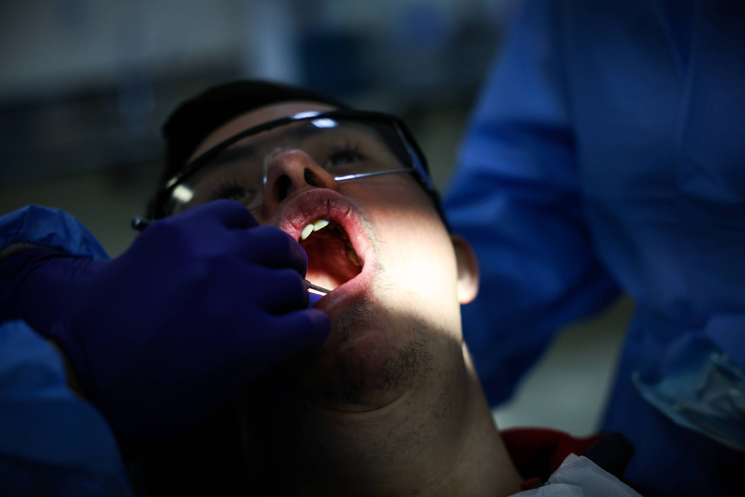 Bactérias da boca podem ser aliadas na detecção precoce de câncer intestinal