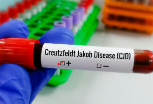 Ciência intensifica busca por terapias contra a rara doença de Creutzfeldt-jakob
