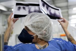 Diagnóstico tardio de câncer de pulmão compromete cura de milhares de brasileiros