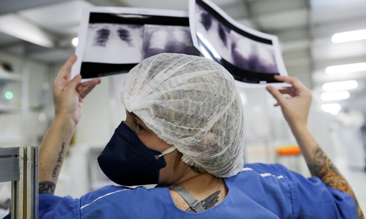 Diagnóstico tardio de câncer de pulmão compromete cura de milhares de brasileiros