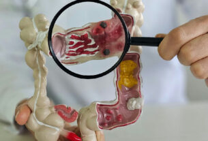 Doenças inflamatórias intestinais disparam cinco vezes no Brasil e acendem alerta de saúde pública