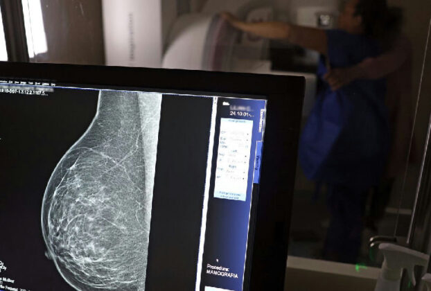Planos de saúde passam a cobrir mamografia digital sem restrição de idade