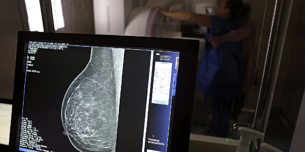 Planos de saúde passam a cobrir mamografia digital sem restrição de idade