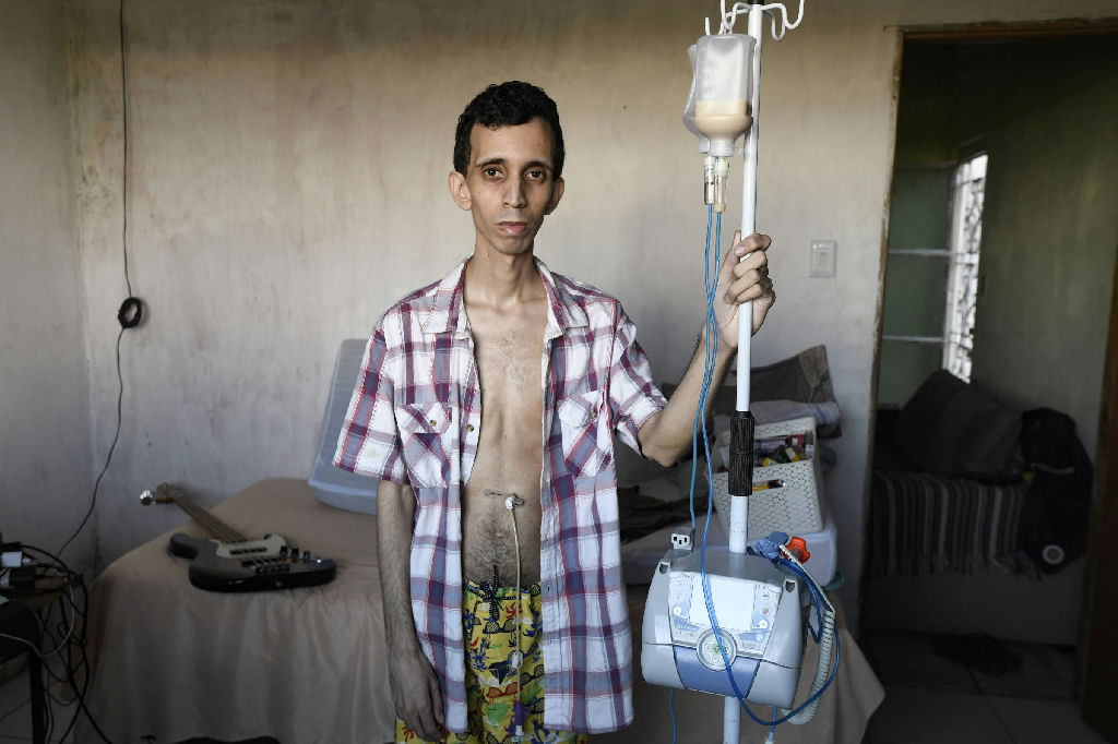 Diagnóstico tardio: a odisseia de pacientes com doenças raras no Brasil