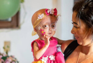 Elis Lima Carneiro morre aos 5 anos: entenda a progéria e seus impactos